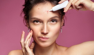 Acne & Breakouts
