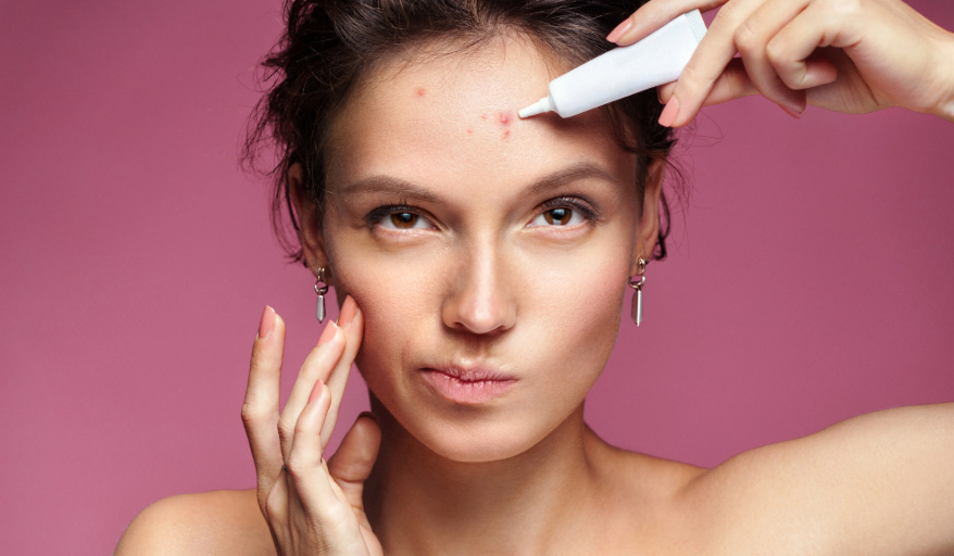 Renaissance Understanding Acne & Breakouts: Causes, Concerns, and Solutions